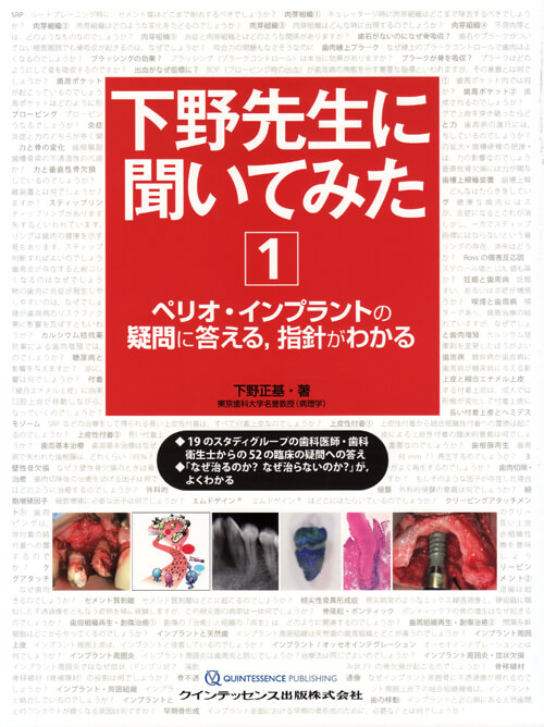 book 下野先生に聞いてみた①ペリオ・インプラントの疑問に答える、指針がわかる